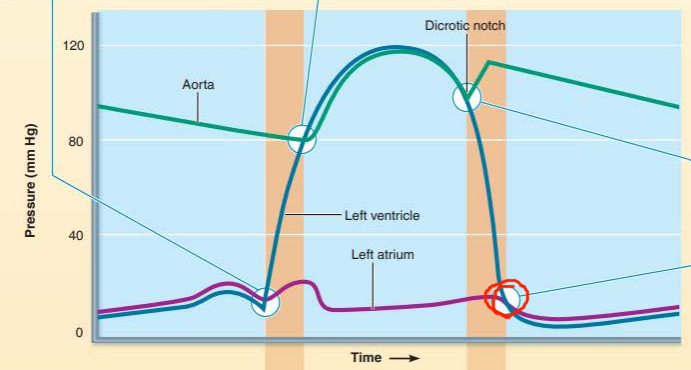 <p>describe the valve events happening</p><p>what sound does it cause?</p><p></p><p>________________ ________ open when the ___________ ___________ drops below ________ _________  resulting in ____ ______ _______</p>