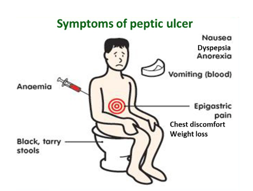 <p>♪Acute peptic ulcers are less frequent and typically develop from areas of corrosive gastritis in the oesophagus, stomach, or proximal duodenum, as well as severe stress or shock such as burns or trauma.</p><p>♪They result from acute hypoxia of the surface epithelium, which leads to ischaemia of the gastric mucosa.</p>