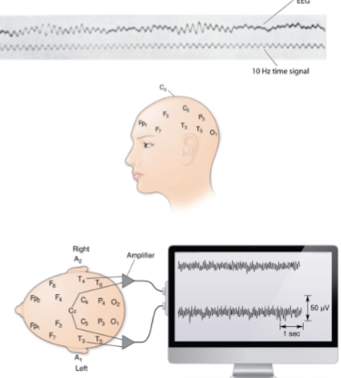 <p>An EEG is a measurement of electrical activity generated by the brain and recorded from the scalp.</p>