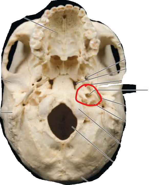 <p>Carotid Canal</p>