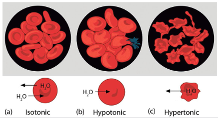 <p>hypotonic solution, hypertonic solution, and isotonic solution</p>