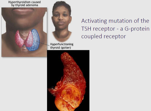 <p>✿An activating mutation of the TSH receptor results in its continuous stimulation, regardless of the presence of TSH.</p><p>✿This constant activation leads to uncontrolled production and release of thyroid hormones, causing hyperthyroidism.</p><p>✿The mutation essentially bypasses the normal regulatory mechanisms of thyroid hormone synthesis and secretion, resulting in dysregulated thyroid function.</p>