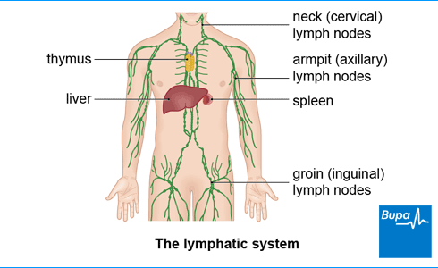 <p>Lymphatic removal, such as in surgery to treat testicular cancer, can cause lymphoedema by removing lymphatics, disrupting normal lymphatic drainage</p>