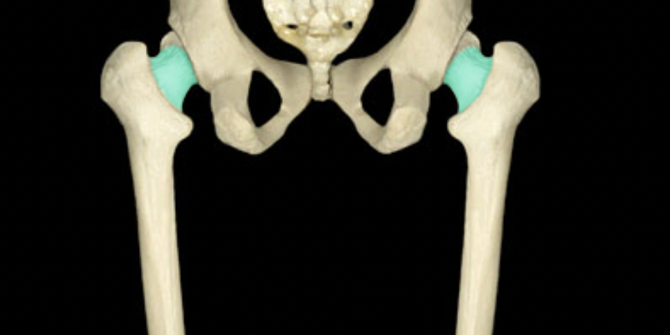 <p>of femur</p>