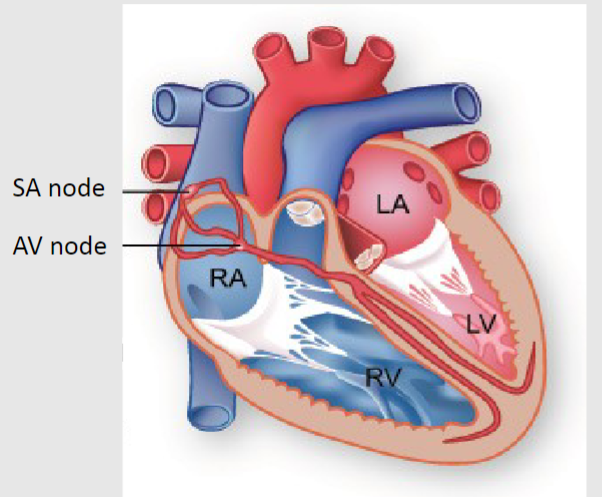 <p>-SA node is a <span class="tt-bg-yellow">group of cells</span> located in the wall of the right atrium</p><p>-Ability to spontaneously <span class="tt-bg-blue">produce action potential</span> that travels through the heart via the electrical conduction system</p><p>-Sets the rhythm of the heart and so is known as the heart's <span class="tt-bg-red">natural pacemaker</span></p><p>-The rate of action potential production (and therefore the heart rate) is <span class="tt-bg-green">influenced by nerves</span> that supply it</p>