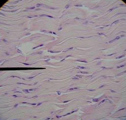 <p>What tissue type is this?</p>