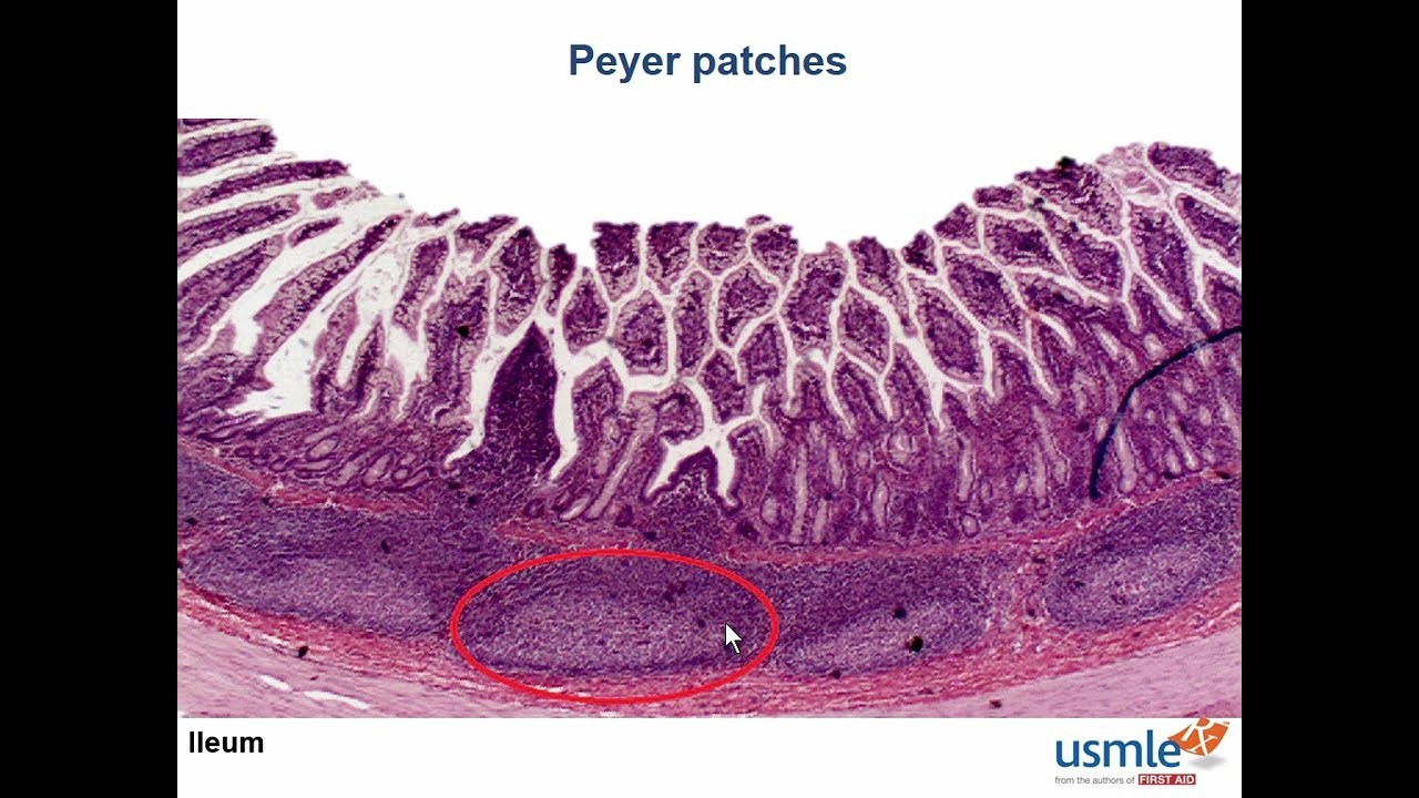 <p>☆ Peyer's patches</p>