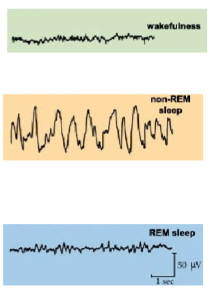 <p><strong>Wakefulness:</strong> Active state where the brain processes sensory input and controls body movements.</p><p><strong>Non-REM Sleep:</strong> Body can move involuntarily, but there are rarely vivid dreams. Described as an "idling brain in a moveable body."</p><p><strong>REM Sleep:</strong> Body is immobilized, but vivid and detailed dreams occur. Known as "an active, hallucinating brain in a paralysed body."</p>