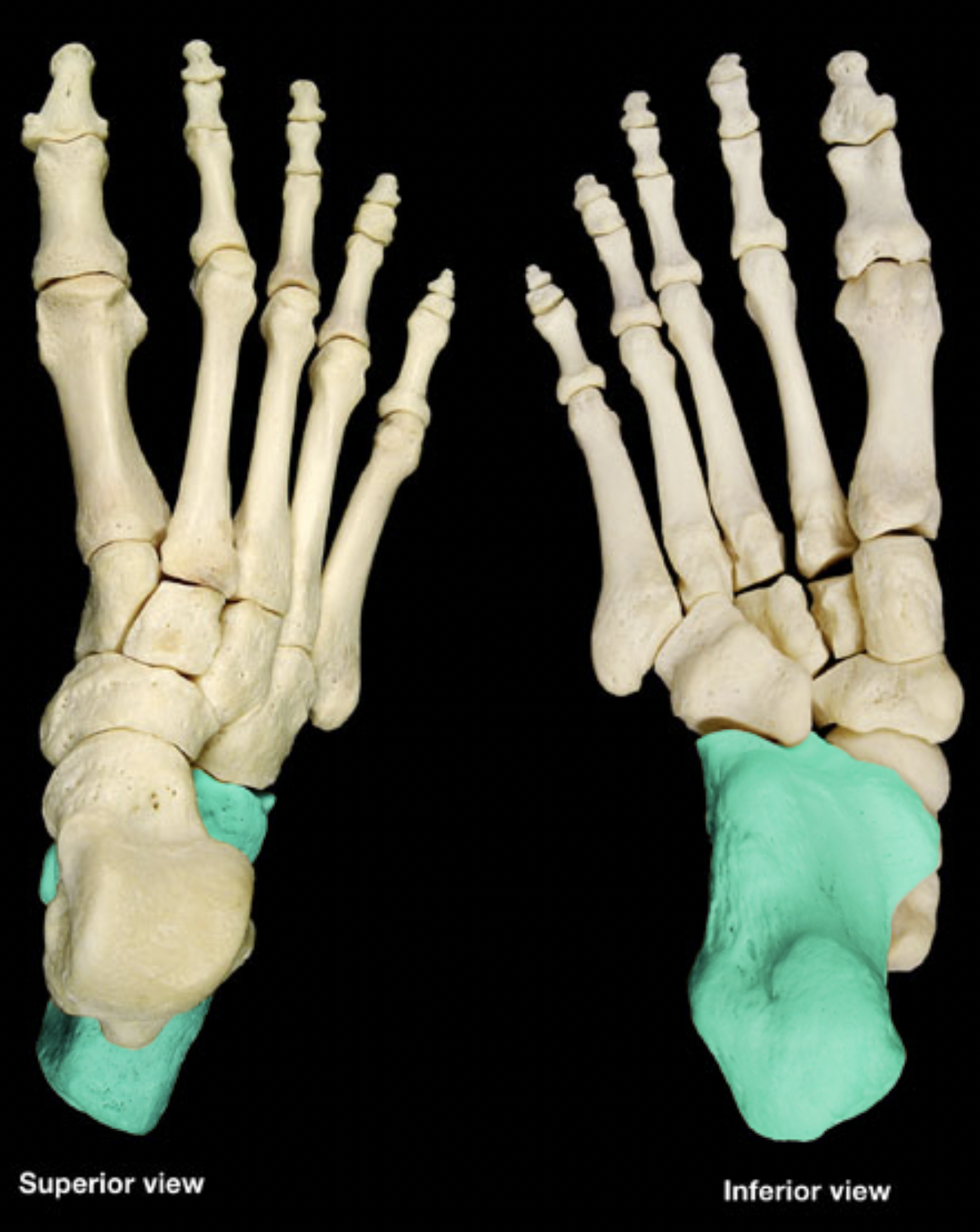 <p>of tarsals</p>