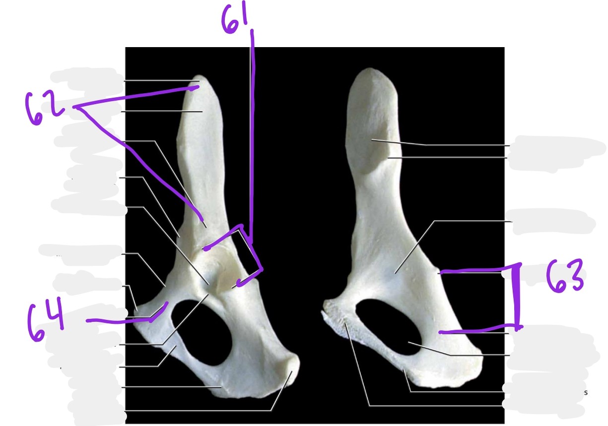 <p>61. acetabulum</p><p>62. ilium</p><p>63. ischium</p><p>64. pubis / point out pubic symphosis</p>