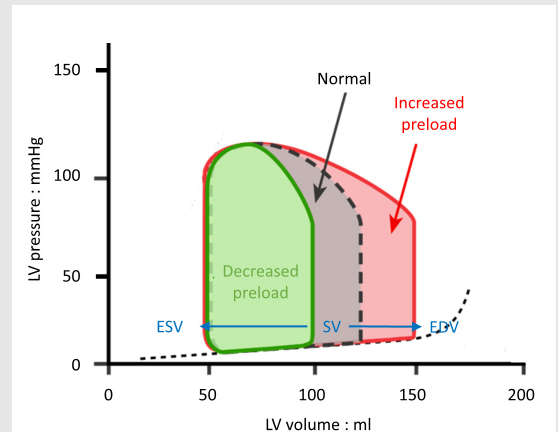 <p>-During exercise, increased venous return leads to increased preload and higher end diastolic volume (EDV)</p><p>-The ventricle will eject blood to the same end systolic volume (ESV) so there is an increase in stroke volume, shown by an increase in the width of the PV loop</p>