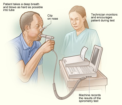 <p>Spirometry</p>