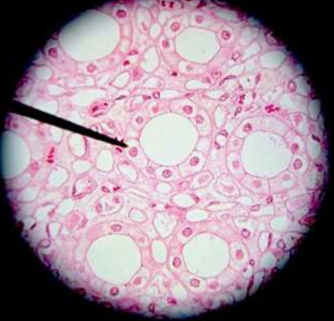 <p>What type of tissue is this? Where in the body could you find this tissue type?</p>