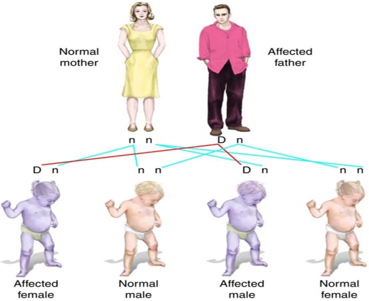 <p>Autosomal <em><u>dominant </u></em>inheritance pattern</p>