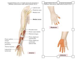 <p>C6-T1</p><p>Formed from <u>medial and lateral cords</u>, anterior division of the brachial plexus</p><p><u>motor innervation</u></p><p>-<strong>Most anterior forearm muscles (flexor carpi radialis, thumb, later 2 lumbrical)</strong></p><p><u>Cutaneous Innervation</u></p><p>Palmar aspects and dorsal tips of lateral 3-1/2 digits (<em>thumb, index finger, middle finger, and 1/2 of ring finger</em></p>