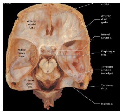 <p>The <strong>Diaphragma Sellae</strong> is a <strong>circular fold of dura mater</strong> that covers the <strong>hypophyseal fossa</strong>.</p><p>It is pierced by the <strong>infundibular stalk</strong> of the <strong>pituitary gland</strong>.</p><p>The <strong>intercavernous sinus</strong> is contained within the Diaphragma Sellae.</p>