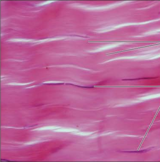 <p>Identify this tissue</p><p></p><p>Name a function</p><p></p><p>Name a specific place where it is found</p>