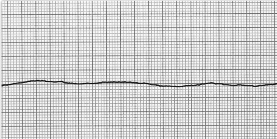 <p>Identify the rhythm pictured</p>