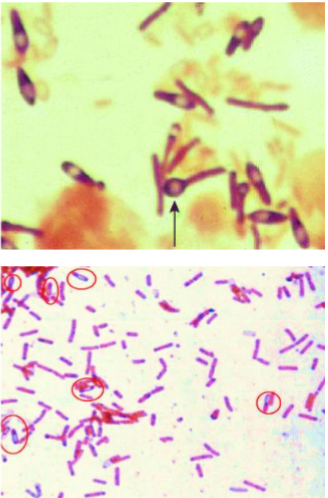 <p>Clostridium tetani</p><p>(tetanus)</p><p></p><p>Clostridium perfringens</p><p>(gangrene)</p><p></p><p>Clostridium difficile</p><p>(pseudomembranous colitis)</p><p></p><p>Bacillus anthrax</p><p>(anthrax)</p>