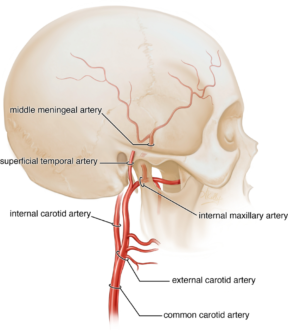 <p>What clinical symptoms and conditions are associated with the dura mater? (2)</p>