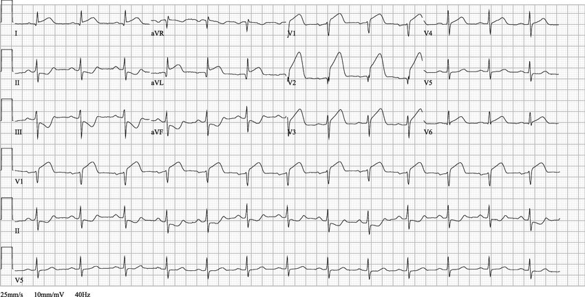 <p>Identify the rhythm pictured</p>