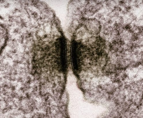 <p>Anchoring junction/desmosomes</p>