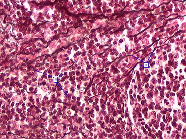 <p>Similar to areolar tissue but contains <span class="tt-bg-yellow">only reticular fibres</span> and <span class="tt-bg-yellow">supports certain structures</span></p>