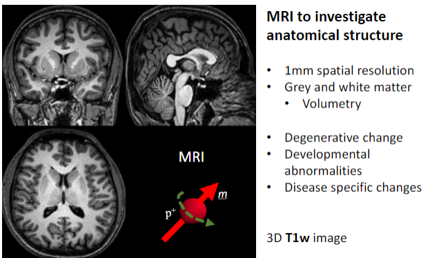 <p><strong>Volumetry</strong> (measuring brain volume).</p><p>Detecting <strong>degenerative changes</strong>.</p><p>Identifying <strong>developmental abnormalities</strong>.</p><p>Observing <strong>disease-specific changes</strong>.</p>