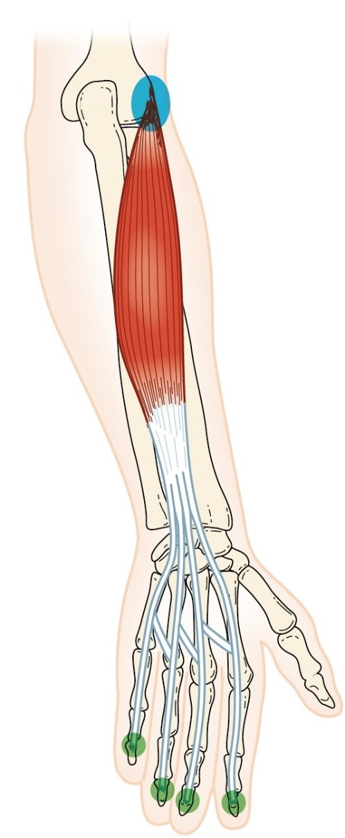 <p>Extensor Digitorum</p>