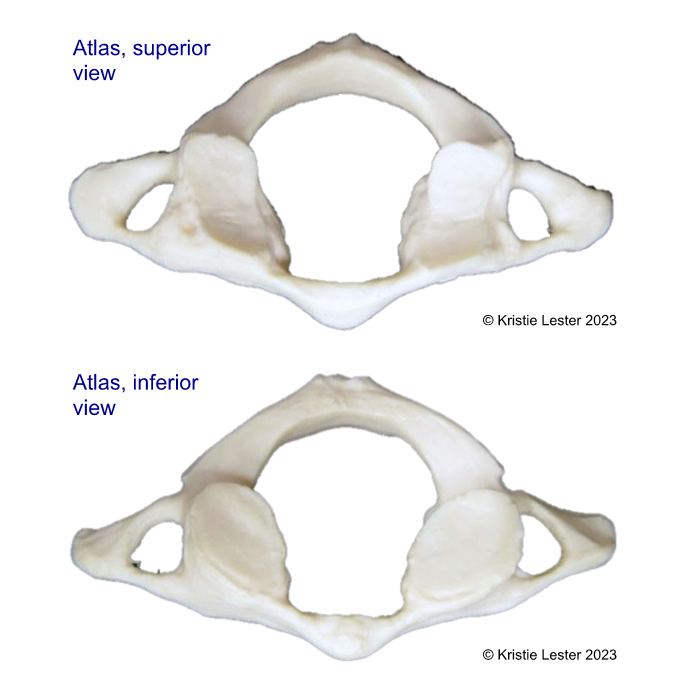 <p>What vertebrae is this? What defining features does it have that the other two groups of vertebrae dont?</p>