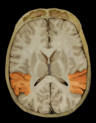 <p>What is the location of the Temporal Lobe?</p>