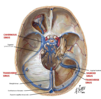 <p>The <strong>Tentorium Cerebelli</strong> is a tent-like fold of dura mater.</p><p>It lies between the <strong>cerebrum</strong> and <strong>cerebellum</strong>.</p><p>It is pulled up by its attachment to the <strong>Falx Cerebri</strong>.</p><p>It has <strong>attached</strong> and <strong>free</strong> margins.</p>