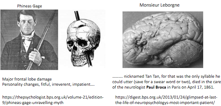 <p>Suffered major frontal lobe damage.</p><p>Resulted in personality changes: fitful, irreverent, impatient.</p>