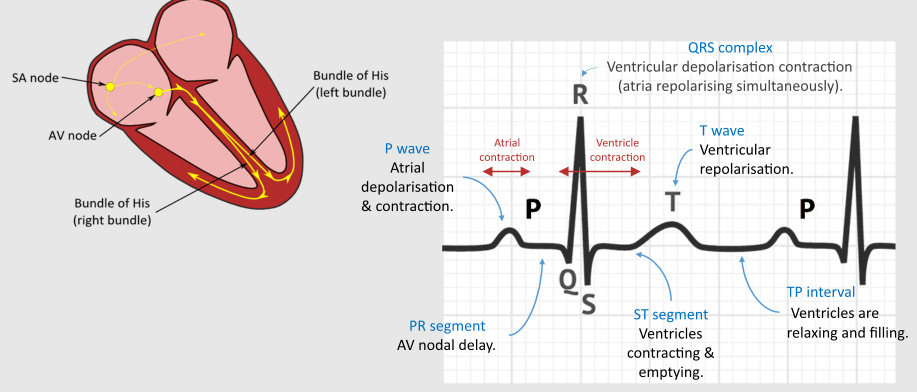 <p>Ventricular depolarisation contraction (atria repolarising simultaneously)</p>