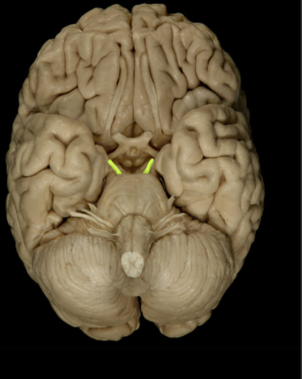<p>Location of the Oculomotor nerve?</p>