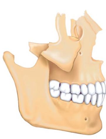 <p>What bone grouping is this?</p>