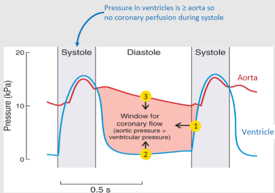 <p>Hypotension reduces diastolic arterial pressure, which can decrease coronary blood flow during diastole</p>