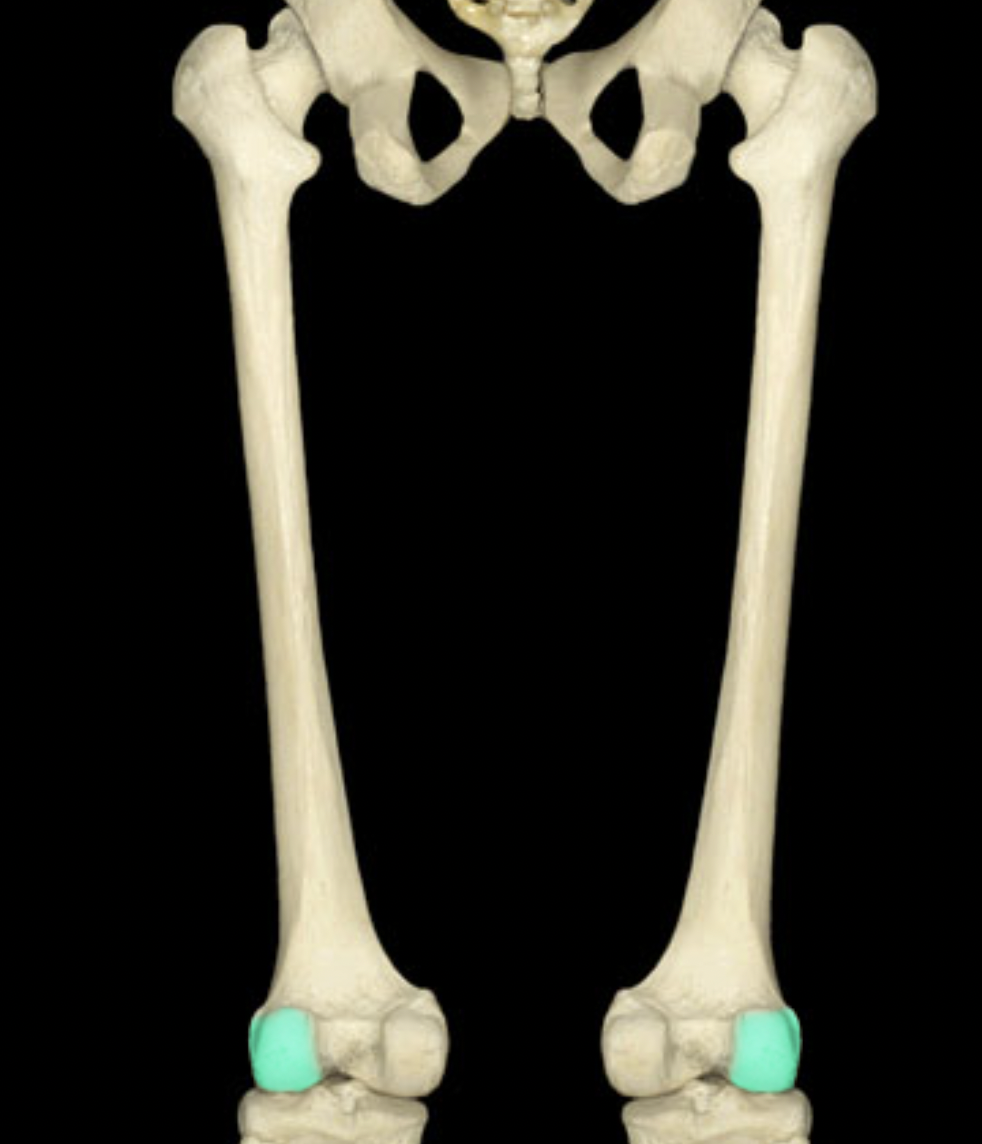 <p>of femur</p>