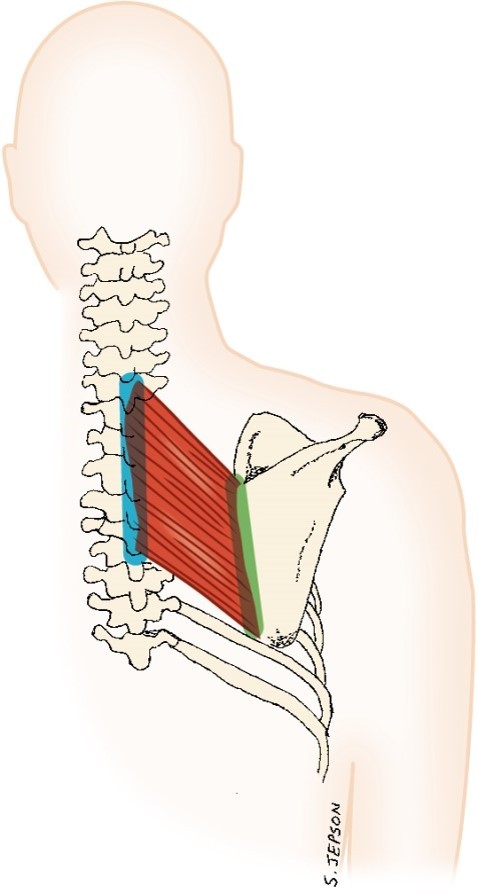 <p>rhomboid </p>