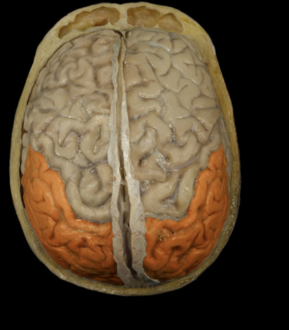 <p>Where is the Parietal Lobe located?</p>