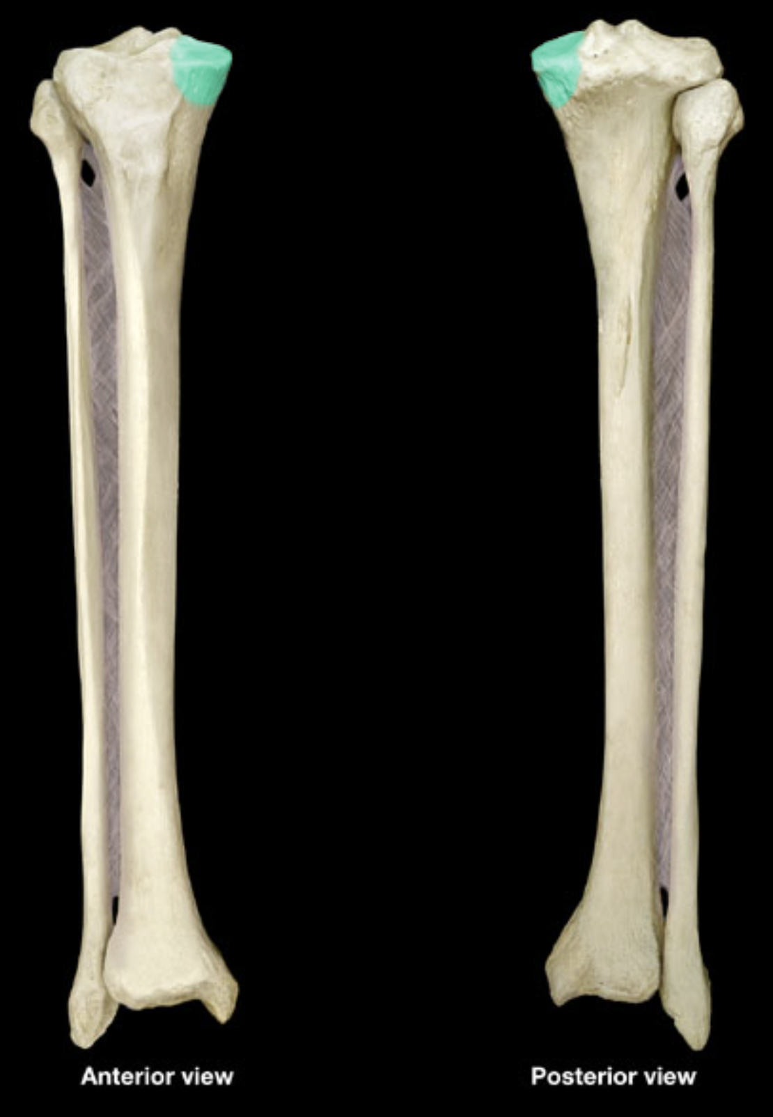 <p>of tibia</p>