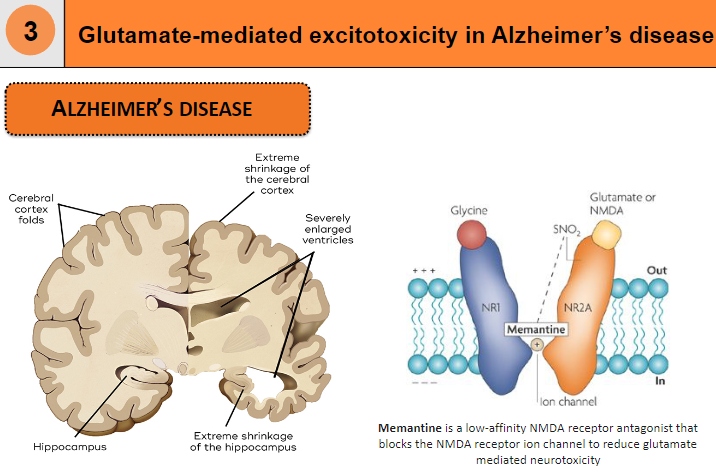 <p>Memantine is a low-affinity NMDA receptor antagonist</p><p>It blocks the NMDA receptor ion channel to reduce glutamate-mediated neurotoxicity</p>