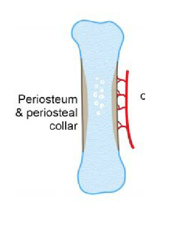 <p><strong>Mesenchymal cells</strong> differentiate into <strong>chondrocytes</strong>.</p><p>These cells produce a <strong>hyaline cartilage model</strong> of the future bone.</p><p>A <strong>cuff of bone</strong> forms around the <strong>diaphysis</strong> (shaft) in long bones.</p><p><strong>Chondrocytes</strong> grow and mature in the <strong>zone of hypertrophy</strong>.</p>