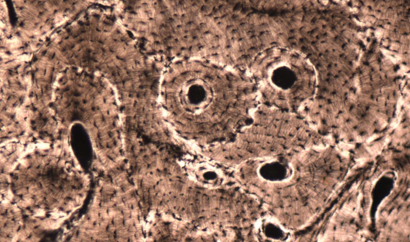 <p>What type of tissue is this? Whats the components of its extracellular matrix?</p>