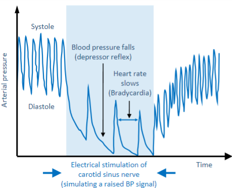 <p><strong>An increase in BP, termed loading (e.g., due to stress or exercise), leads to several responses:</strong></p><p>-Pulse pressure (compliance) falls due to decreased stroke volume</p><p>-Vasodilation decreases total peripheral resistance (TPR) and BP</p><p>-There is a decrease in sympathetic nerve activity.</p><p>-Vagus nerve activity increases (parasympathetic activity)</p>