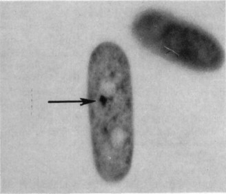 <p>What is the result of X-inactivation at the chromosomal level? (1)</p>