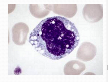 Non-Granulocyte: Monocyte (less common)