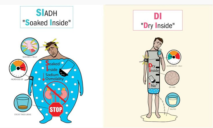 <p>Treatment for SIADH typically involves fluid restriction to prevent further water retention. In some cases, medications like demeclocycline or ADH antagonists such as tolvaptan may be prescribed to counteract the effects of excess ADH.</p>