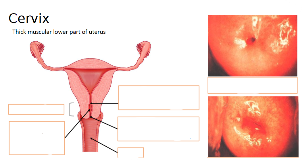 <p>Label these parts of the cervix:</p>