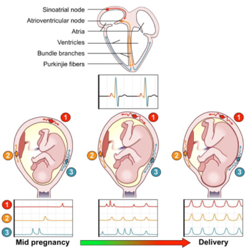 <p>Spontaneous depolarization of 'pacemaker' cells in the myometrium.</p><p>These pacemaker cells generate action potentials that trigger contractions.</p>